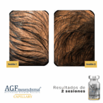 AGF Mesenchymal Capillary - Image 3
