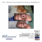 AGF Mesenchymal Biomask - Image 3