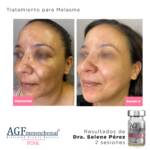 AGF Mesenquimal Pink - Image 7