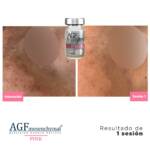 AGF Mesenquimal Pink - Image 4