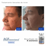AGF Mesenquimal Dermal - Image 2