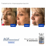 AGF Mesenquimal Dermal - Image 3