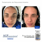 AGF Mesenquimal Dermal - Image 4