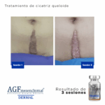 AGF Mesenquimal Dermal - Image 5